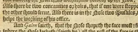 An illustration from The English mans treasure : with the true anatomie of mans bodie (1599)
