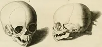 Picture 102 of 266 from Essai sur la physiognomonie : destiné a faire connoître l'homme & à le faire aimer (1781), leaf 203