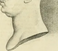 An illustration from Essai sur la physiognomonie : destiné a faire connoître l'homme & à le faire aimer (1781)