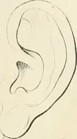 Picture 220 of 237 from Essai sur la physiognomonie : destiné a faire connoître l'homme & à le faire aimer (1781), leaf 433