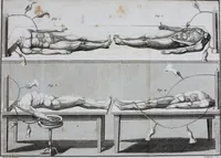 An illustration from Essai théorique et expérimental sur le galvanisme : avec une série d'expériences faites en présence des commissaires de l'Institut national de France, et en divers amphithéatres anatomiques de Londres (1804)