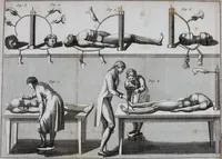An illustration from Essai théorique et expérimental sur le galvanisme : avec une série d'expériences faites en présence des commissaires de l'Institut national de France, et en divers amphithéatres anatomiques de Londres (1804)