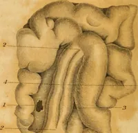 An illustration from Essays on phrenology : or an inquiry into the principles and utility of the system of Drs. Gall and Spurzheim, and into the objections made against it (1822)