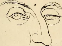 An illustration from Essays on physiognomy; calculated to extend the knowledge and the love of mankind (1797)