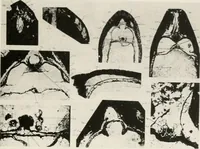 An illustration from The essentials of illustration, a practical guide to the reproduction of drawings & photographs for the use of scientists & others (1915)