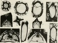 An illustration from The essentials of illustration, a practical guide to the reproduction of drawings & photographs for the use of scientists & others (1915)