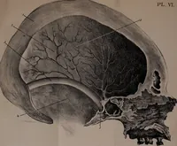 Picture 10 of 12 from An examination of phrenology; (1837), leaf 100