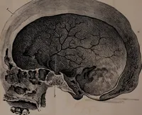 Picture 11 of 12 from An examination of phrenology; (1837), leaf 104