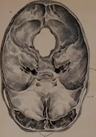 Picture 12 of 12 from An examination of phrenology; (1837), leaf 108