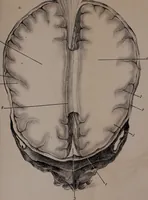 Picture 4 of 12 from An examination of phrenology; (1837), leaf 84