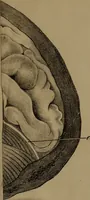 An illustration from An examination of phrenology; (1837)