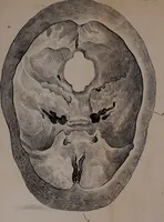 Picture 8 of 12 from An examination of phrenology; (1837), leaf 96