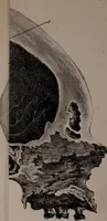 Picture 9 of 12 from An examination of phrenology; (1837), leaf 98