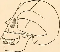 An illustration from Forty years in phrenology; embracing recollections of history, anecdote, and experience (1888)