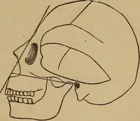 An illustration from Forty years in phrenology; embracing recollections of history, anecdote, and experience (1882)