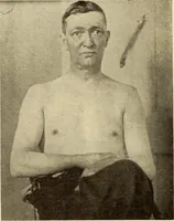 Picture 58 of 481 from Fractures and dislocations, diagnosis and treatment (1915), leaf 103
