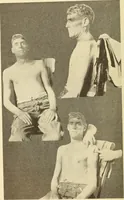 Picture 64 of 481 from Fractures and dislocations, diagnosis and treatment (1915), leaf 109