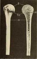 An illustration from Fractures and dislocations, diagnosis and treatment (1915)