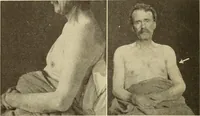 Picture 70 of 481 from Fractures and dislocations, diagnosis and treatment (1915), leaf 121