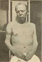 Picture 73 of 481 from Fractures and dislocations, diagnosis and treatment (1915), leaf 124
