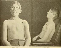 Picture 74 of 481 from Fractures and dislocations, diagnosis and treatment (1915), leaf 125