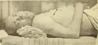An illustration from Fractures and dislocations, diagnosis and treatment (1915)