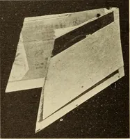 An illustration from Fractures and dislocations, diagnosis and treatment (1915)