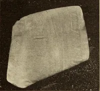 An illustration from Fractures and dislocations, diagnosis and treatment (1915)