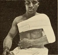 An illustration from Fractures and dislocations, diagnosis and treatment (1915)