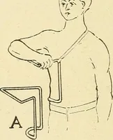 An illustration from Fractures and dislocations, diagnosis and treatment (1915)