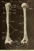 An illustration from Fractures and dislocations, diagnosis and treatment (1915)