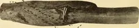 An illustration from Fractures and dislocations, diagnosis and treatment (1915)