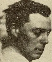 An illustration from Fractures and dislocations, diagnosis and treatment (1915)