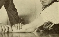 An illustration from Fractures and dislocations, diagnosis and treatment (1915)