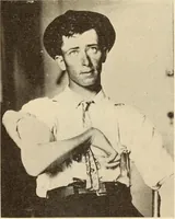 Picture 115 of 481 from Fractures and dislocations, diagnosis and treatment (1915), leaf 172
