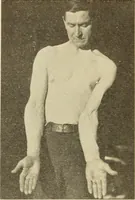 An illustration from Fractures and dislocations, diagnosis and treatment (1915)