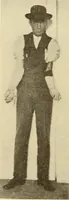 An illustration from Fractures and dislocations, diagnosis and treatment (1915)