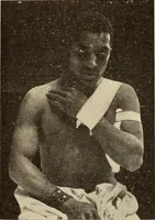 Picture 118 of 481 from Fractures and dislocations, diagnosis and treatment (1915), leaf 176