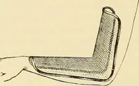 Picture 119 of 481 from Fractures and dislocations, diagnosis and treatment (1915), leaf 177
