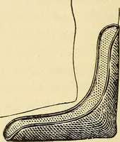 An illustration from Fractures and dislocations, diagnosis and treatment (1915)