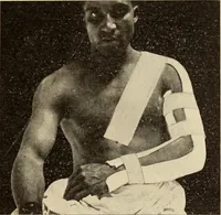 Picture 123 of 481 from Fractures and dislocations, diagnosis and treatment (1915), leaf 178