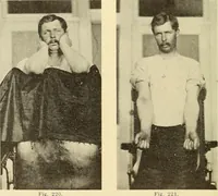 Picture 125 of 481 from Fractures and dislocations, diagnosis and treatment (1915), leaf 181