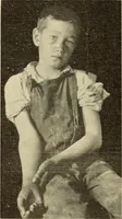 An illustration from Fractures and dislocations, diagnosis and treatment (1915)