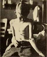 Picture 137 of 481 from Fractures and dislocations, diagnosis and treatment (1915), leaf 210
