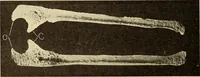 Picture 153 of 481 from Fractures and dislocations, diagnosis and treatment (1915), leaf 235