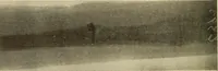 An illustration from Fractures and dislocations, diagnosis and treatment (1915)