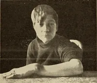 An illustration from Fractures and dislocations, diagnosis and treatment (1915)