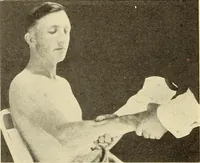 Picture 171 of 481 from Fractures and dislocations, diagnosis and treatment (1915), leaf 251