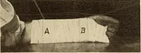 Picture 173 of 481 from Fractures and dislocations, diagnosis and treatment (1915), leaf 254