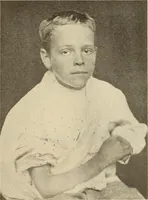 An illustration from Fractures and dislocations, diagnosis and treatment (1915)